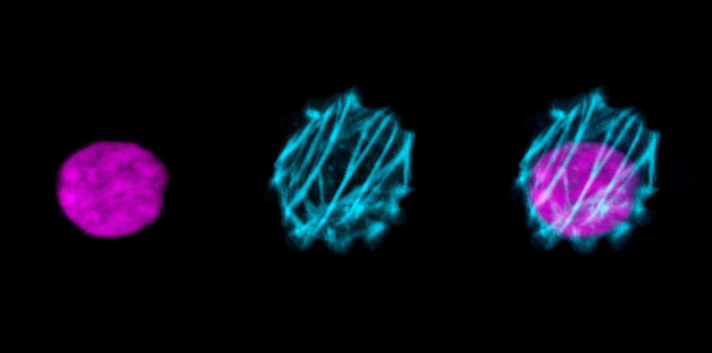 cell_spreading_inhibition.jpg