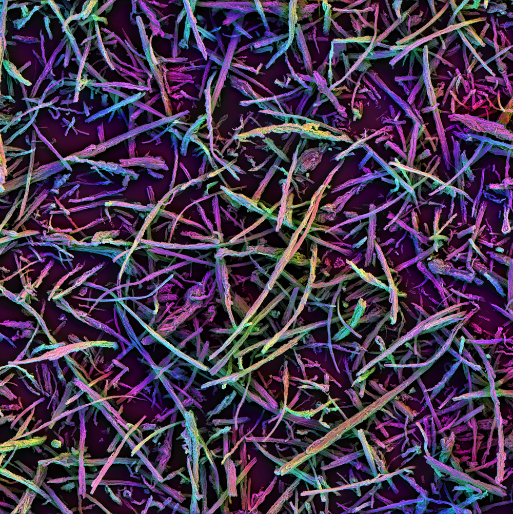 Mesoporous silica microparticles by Aileen Li