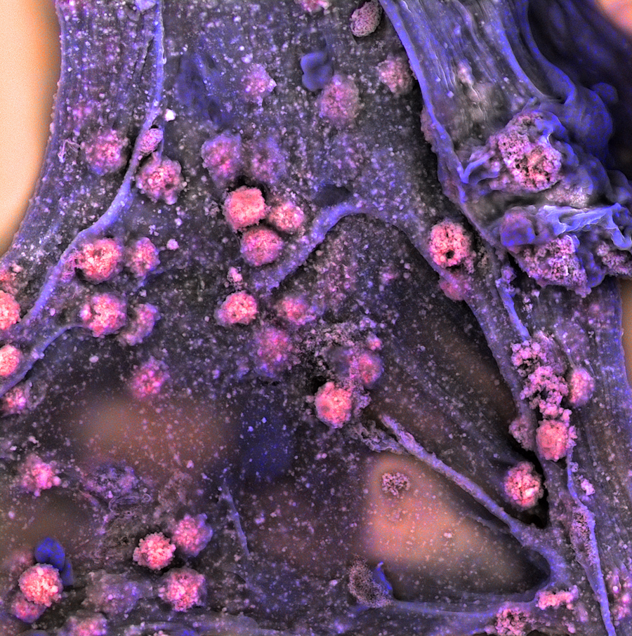 Stem cells in 3D hydrogel_Luo Gu and James Weaver