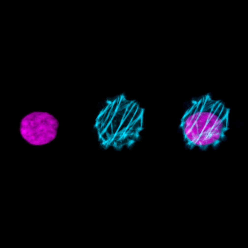 Actin filaments of an inhibited cancer cell_Luo Gu