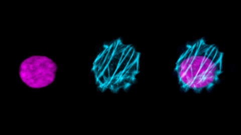 Actin filaments of an inhibited cancer cell_Luo Gu
